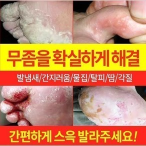 {국내 배송/일본 도쿄 R&D} 발 냄새를 빠르게 제거 / 무좀소독 / 가려움증 방지 및 살균 / 발 필링 / 발흘림 / 발흘림 / 물집 / 기타 발 관리LY009, 1개, 20g