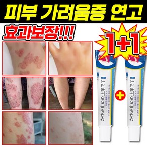 [일본 기술] 1+1/2+2 피부 가려움증 연고 건선 연고 치료제 습진 모낭염 연고 지루성 피부염 각종 피부 트러블 곰팡이균 볽은반점 완화 크림, 2개, 20g