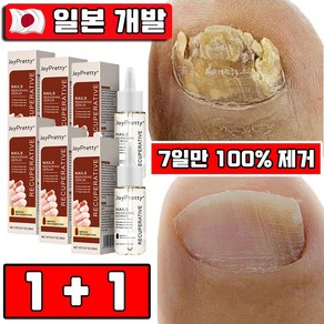 [7일만 100% 제거] 1+1/2+2 손발톱 무좀 앰플 영양제 손톱 발톱 강화 영양제 네일 케어, 2개, 20ml