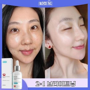 SILIYOUNG 2+1/3+2검버섯제거 잡티 멜라닌 색소침착 무자극 미백 기능성 잡티 나이아신아마이드 잡티 세럼 기미 미백 에센스 앰플, 1개, 30ml