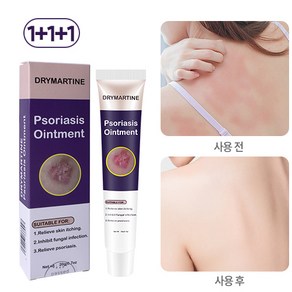 DRYMATYINE 건선 크림 습진크림 발진 가려움 두피건선 가려움완화, 3개, 20ml