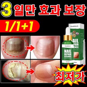 [국내당일출고] 손톱 발톱 앰플 손발톱 영양제 네일 케어 문제성발톱 진균 발톱강화 관리 효과 짱, 1개, 30ml