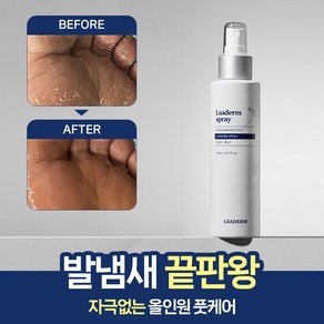 르사덤 스프레이 뿌리는 올인원 발바닥 발가락 간지러움 발냄새 곰팡이균제거제 150ml, 1개, 1개입