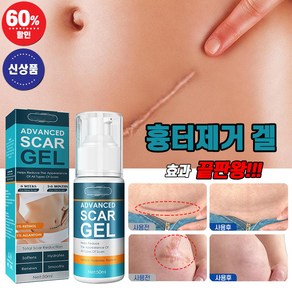 [국내배송] 흉터제거 연고 제왕절개 화상 수술 상처 피부흉터 제거겔 켈로이드 치료 리페어 크림 최저가격, 49.9ml, 1개