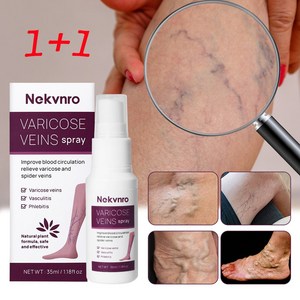 Nekvno 하지정맥 스프레이 정맥 정맥류 케어 다리마사지 붓기빼는약, 2개, 35ml