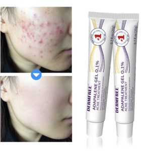 DERMFREE 트러블케어 리페어 크림 스팟 케어 피지케어 크림, 2개, 20g