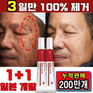 [3일만 100%제거] 1/1+1 기미 미백크림 멜라논크림 색소침착 검버섯 주근깨 기미 제거 미백 화이트닝 멜라토닝 크림 사은품 랜덤 증정, 2개, 20g