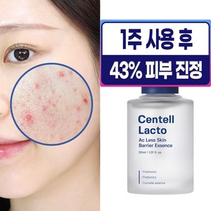 성분에디터 센텔락토 여드름 진정 앰플 트러블 흔적케어 에센스, 1개, 30ml