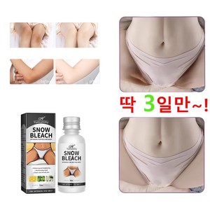 멜라논크림 멜라토닝크림 겨드랑이 색소침착 색소침착연고 멜라닌 억제, 4개, 30ml