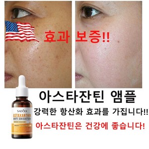 청장 아스타잔틴 앰플 피부의 칙칙함을 개선하고 피부를 부드럽고 매끄럽게 만들며 주름을 줄입니다, 1개, 30ml
