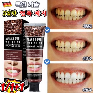 [효과보장] 독일 미백치약 치아미백제 화이트닝 커피/담배 치아 강력 미백, 1개, 100ml