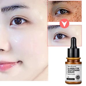 보습과 피부 색 개선과 에센스, 1개, 30ml