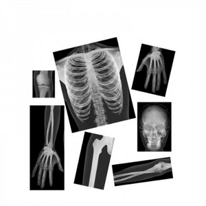 사람 X-Ray 사진세트, 1개