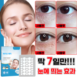 [국내배송] 눈가 비립종 제거 패치 눈밑 지방 입자 제거 패치 한관종 매립종 제거 밴드, 1개, 144개입
