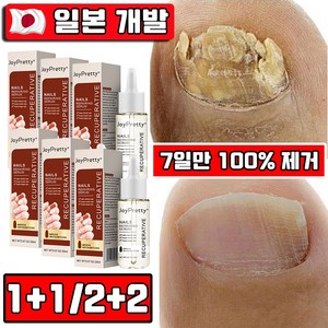 [7일만 100% 제거] 1+1/2+2 손발톱 무좀 앰플 영양제 손톱 발톱 강화 영양제 네일 케어, 2개, 20ml