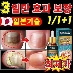 {일본수입} 손톱 두꺼워짐손발톱 무좀오래된 손톱 제거LY024, 2개, 20g