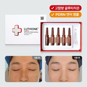 병원용 앰플 글루타치온 모공앰플 PDRN 바르는 botox 연어 줄기세포 DNA, 5개, 2g