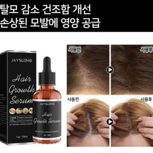 [당일 배송] 원형 탈모증 KS인증 치료제 M자형 예방모낭 성장 개선 LY006, 2개, 29ml