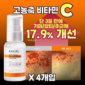 3일 잡티 17.4% 순삭케어 비타민C 잡티이별세럼+고농축 멀티비타민 기미 잡티 세럼 / 비타민 C 고농축 잡티 순삭 케어, 4개