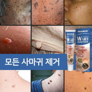 [미국수입원]제거율 99.99 세이프티 포뮬러쾌속적 유효비립종제거편평사마귀얼굴사마귀사상사마귀LK020, 2개, 20g