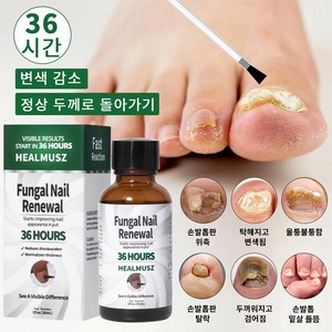 HEALMUSZ 발톱 무좀 앰플 네일 리페어 발톱 강화 발톱 영양제 문제성 발톱 케어 효과보장, 1개, 30ml