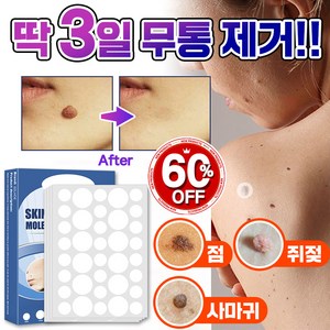 [빠른배송] 피부 제거 패치 얼굴 바디 피부 치료 라벨 스텔스, 1개, 144매입