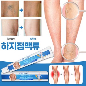 하지정맥류 크림 정맥류 연고 혈관염 다리부종 혈액순환 붓기크림 포장증정, 3개, 20ml