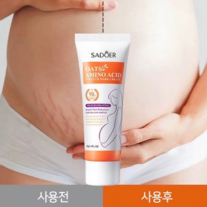 SADOER스트레치 마크 크림-미국 FDA 인증 획득 주로 튼살을 수리합니다 뚱뚱한 선 엄마들이 완벽한 피부를 가지도록 해주세요, 2개, 40g