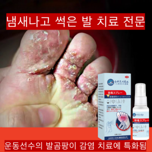 [정품 일본제품/당일배송] 발냄새스프레이/발냄새 땀 갈라진 피부 물집 가려움 이상한 냄새/가벼운 스프레이 하나로 발 문제 해결/QQ07, 1개, 30ml