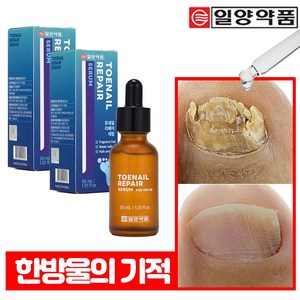 일양약품 문제성 손발톱 전문 리페어 세럼 영양제 토네일, 2개, 30ml