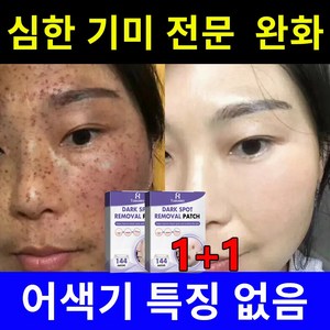 기미패치 기미 크림 멜라토닝크림 멜라논크림 얼굴 기미 멜라닌 색소 완화 촉촉하고 환한 피부 완성, 2개, 144개입