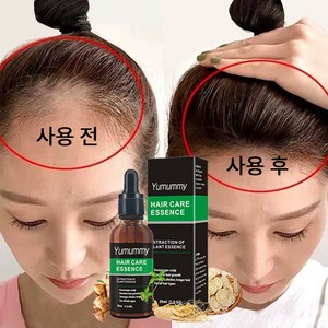 Hai Hai Gowe 두피 케어 세럼 발모제, 2개, 30ml