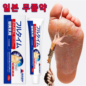 [당일배송] 무좀연고 로빠르고효과적인무좀제거/발냄새/발바닥가려움/발에 땀이나고피부가벗겨지고 물집이생기는 증상 SM004, 2개, 20g