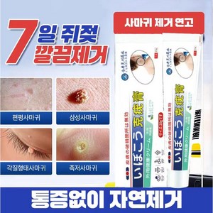 [일본의 기술] 피부 연고 순수 천연 식물 추출물 쾌속적 유효 비립종제거Y001, 1개, 20g