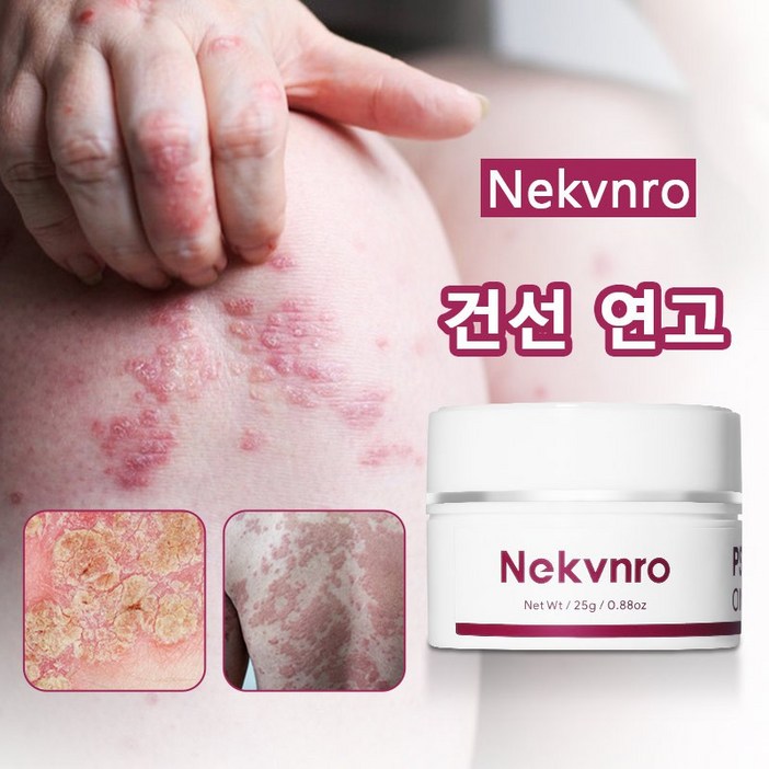 NEKVNRO 습진 건조 건성 가려움증 완화에 효과적