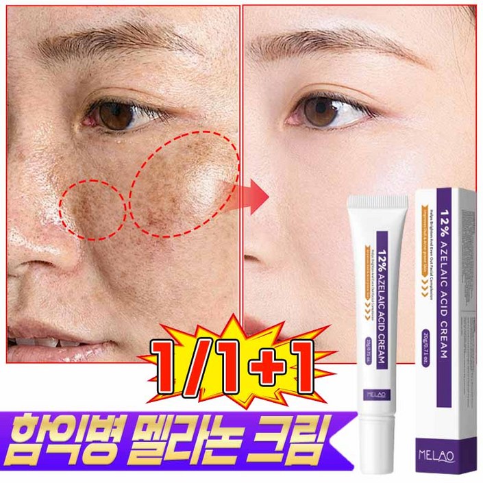 최초가 함익병 멜라논 크림 기미 잡티 제거 크림1위 함익병 멜라논 크림 미백연고 기미크림 검버섯 피부 재생크림 사은품 랜덤증정