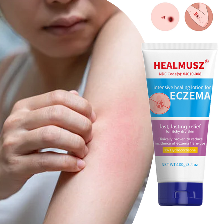 HEALMUSZ습진연고,완화되다 피부 가려움증 습진 건선 땀띠연고 아토피 피부염 헤르페스 수분 크림, 2개, 100ml